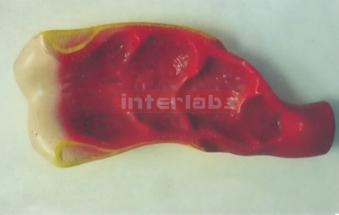 RECTUM INNER CAVITY WITH PLASTIC BASE